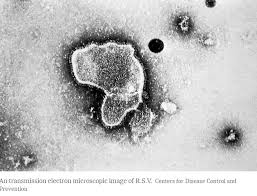 RSV 감염증에 대한 종합 안내