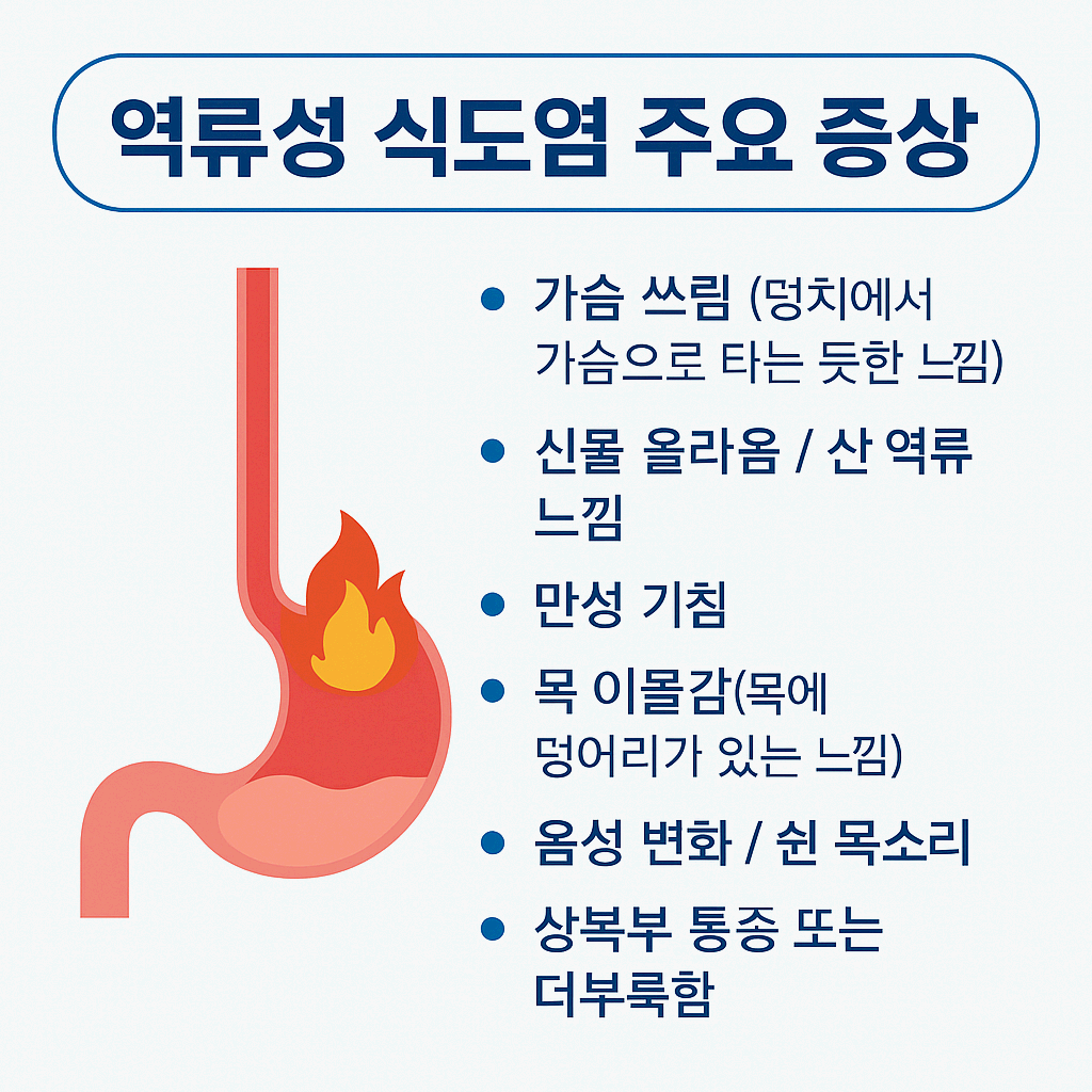 역류성식도염