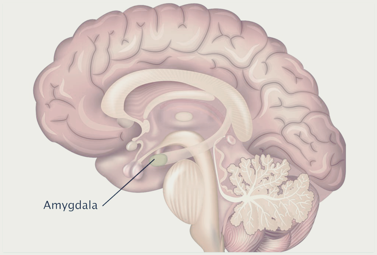 백파이어 효과4