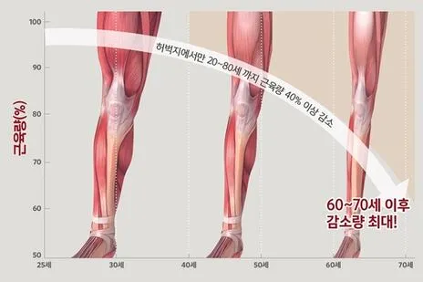 다리에 힘이 없는 증상 4가지 이유와 해결방안_2