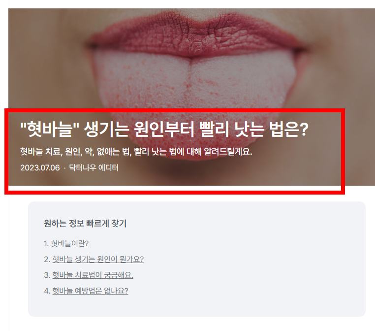 혓바늘이 돋는 이유 알아보기