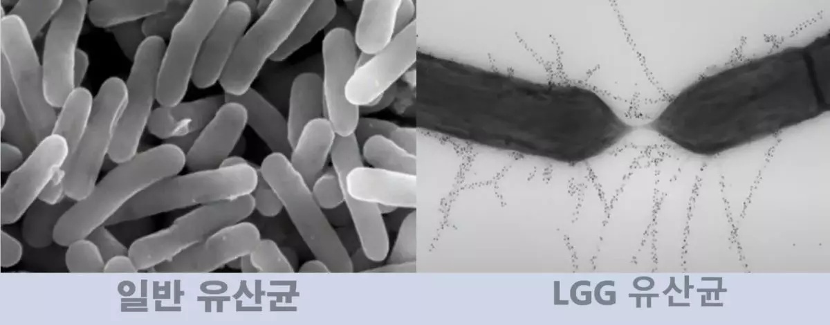 일반 유산균과 LGG 유산균의 차이점