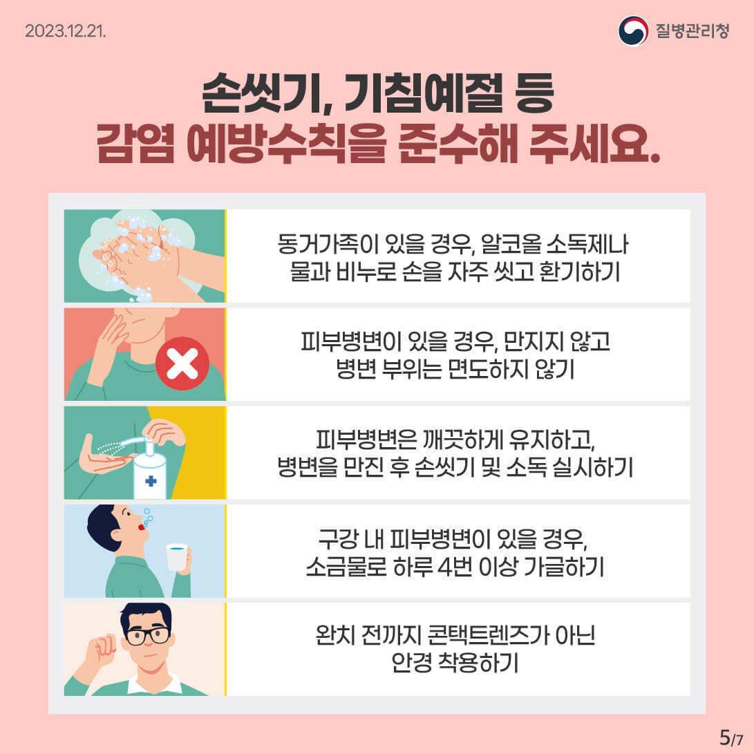 엠폭스 뜻 원인 증상 치사율 치료제 예방접종