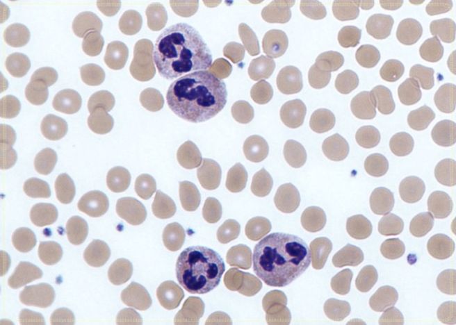 호중구 정상수치