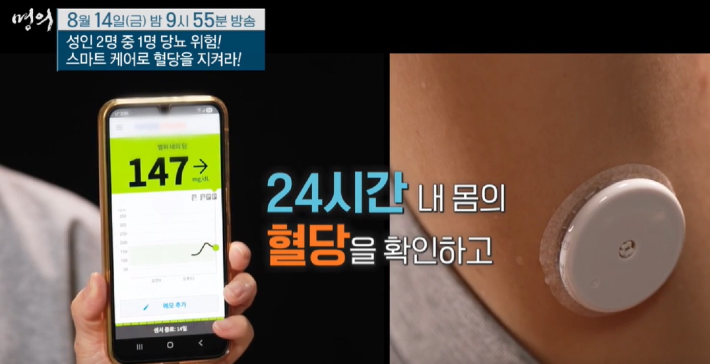 김재현-교수-연속혈당측정기