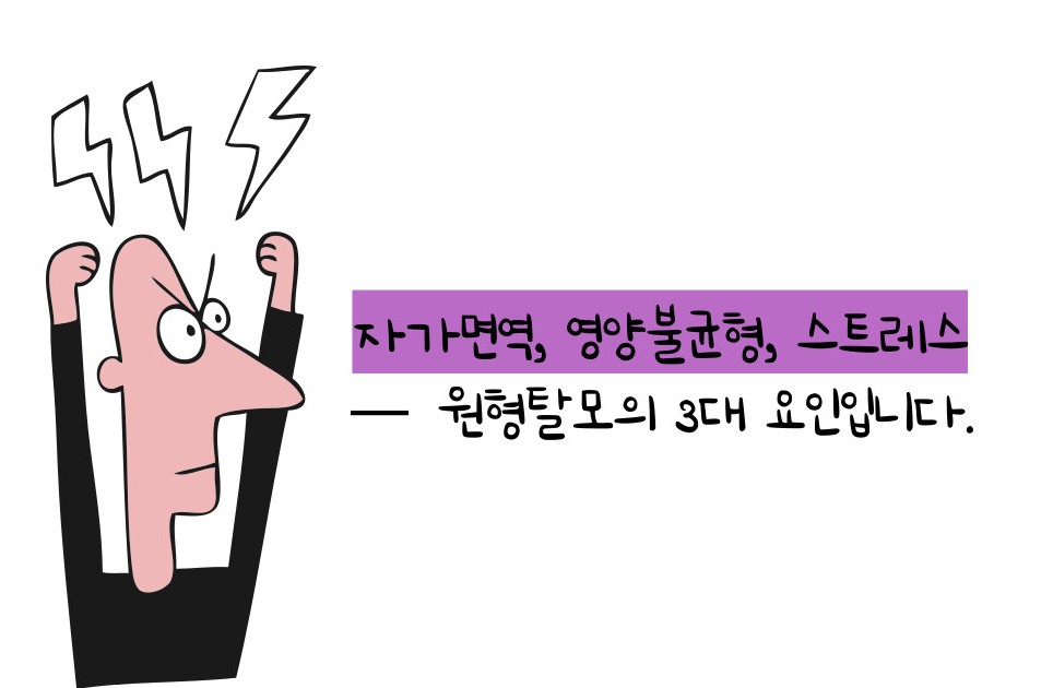 원형탈모 원인