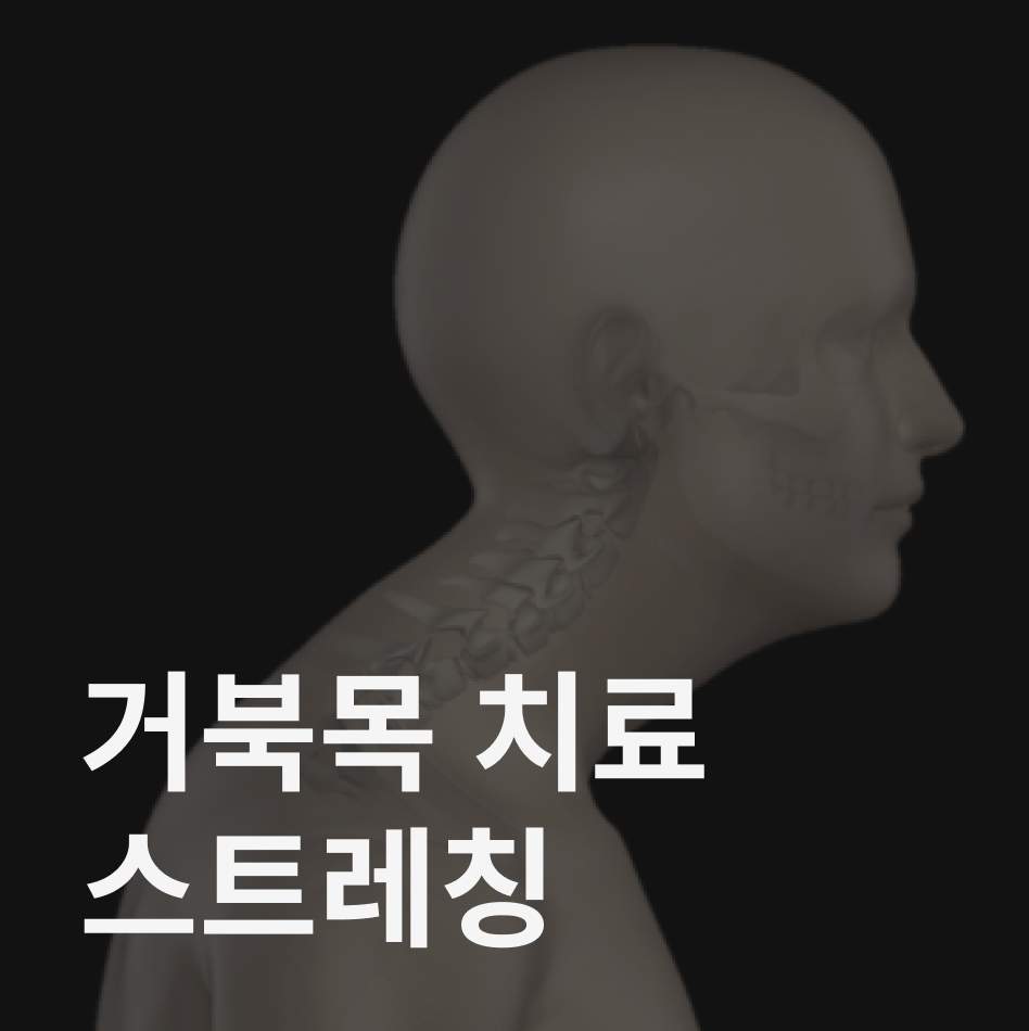 거북목 치료