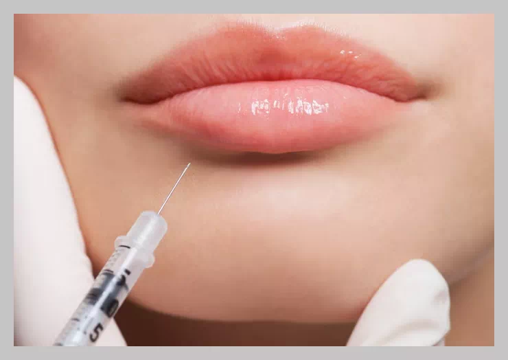 필러 녹이는 주사