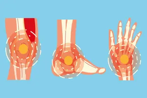 발바닥통증의 원인