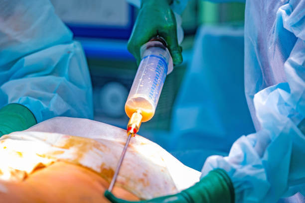 청주 지방이식, 자연스러운 얼굴 라인 복원의 비밀!