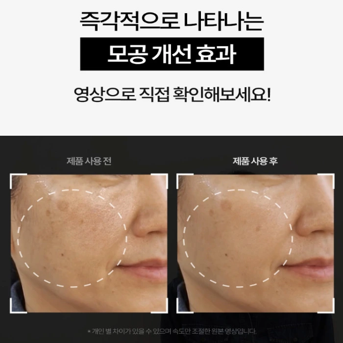 더시드 모공픽서 내돈내산 후기 사용법 효과 부작용 가격