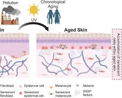 콜라겐 엘라스틴 감소에 의한 40대 피부 처짐 메커니즘