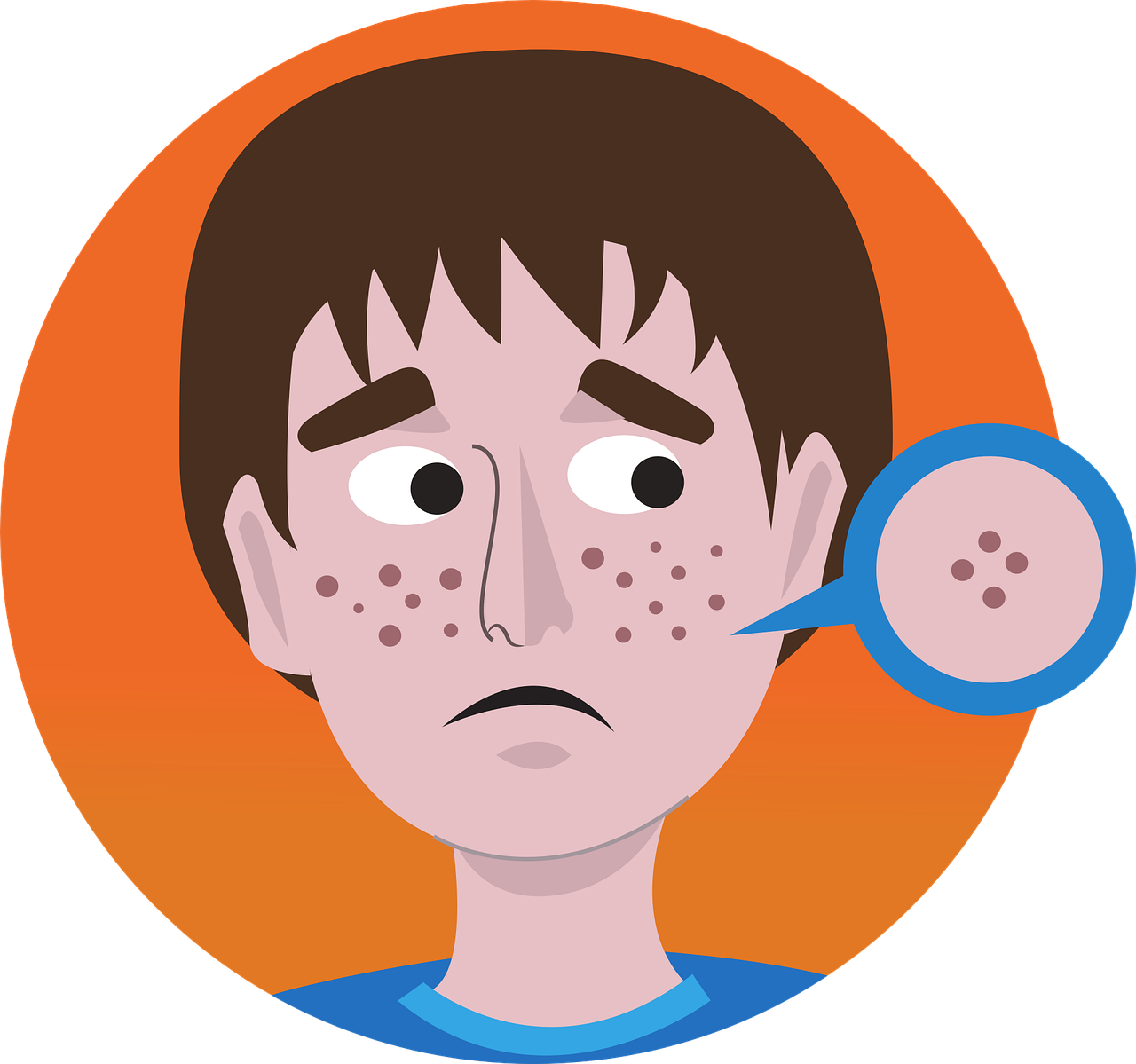 지루성 피부염 관련 사진