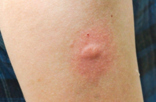 오래된 빌라, 아파트 바퀴벌레 똥과 물린자국으로 서식 여부 알 수 있어요