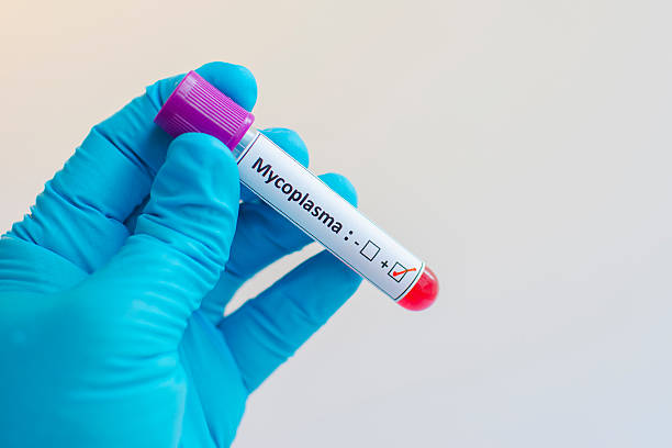 마이코플라스마 미코플라스마 폐렴 소아 주요 증상 검사 치료 항생제 전염 등교 진단 감기 독감 내성