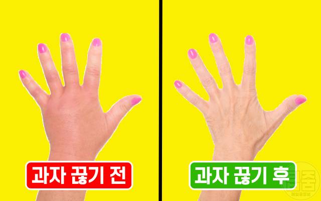 과자 끊기 효과 한달 후 붓기