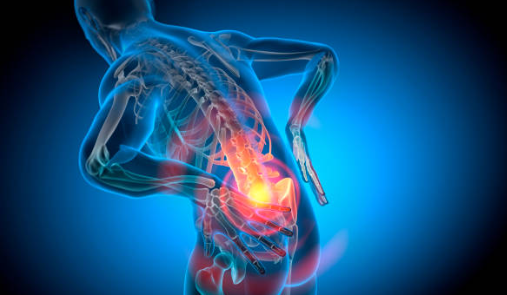 허리 디스크 증상