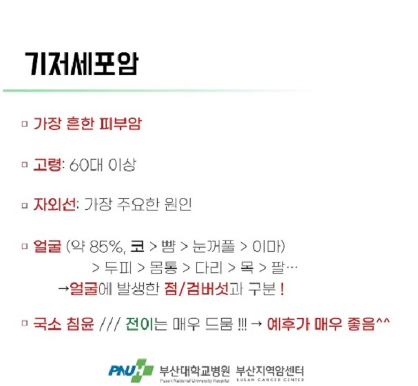 기저세포암