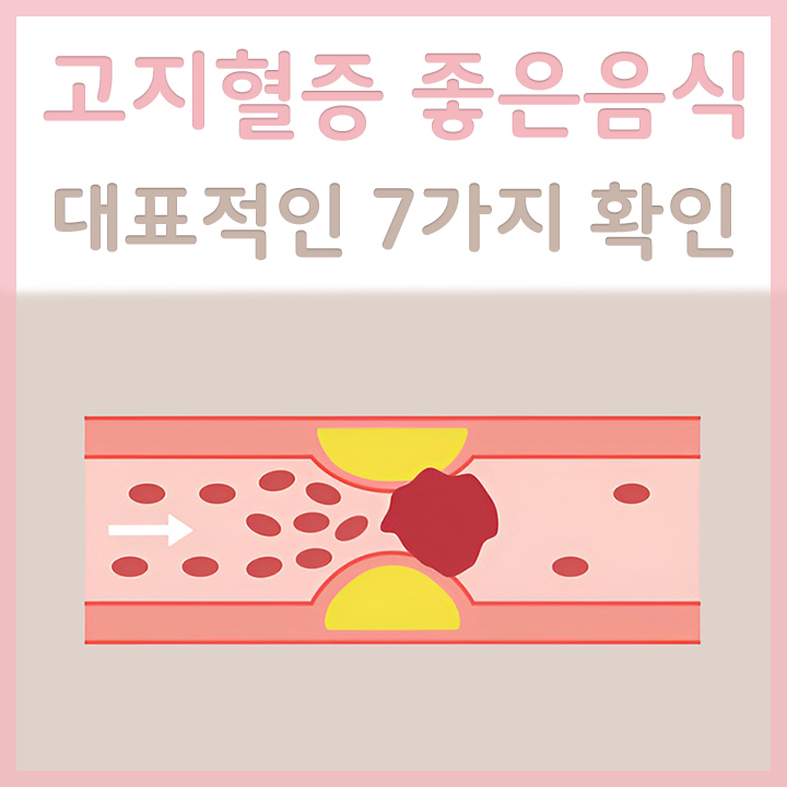 고지혈증이-있는-혈관-모습