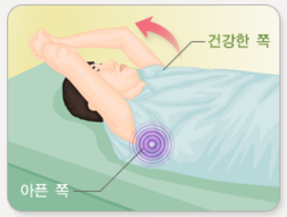 오십견 치료 운동법