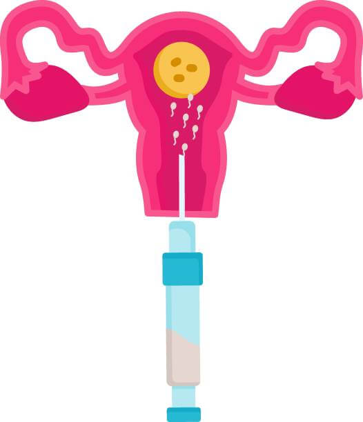 [안산시] 2025 난임&middot;임신 지원 정책 완전 정복 가이드