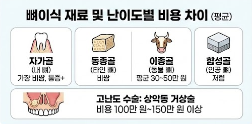 임플란트 뼈이식 비용
