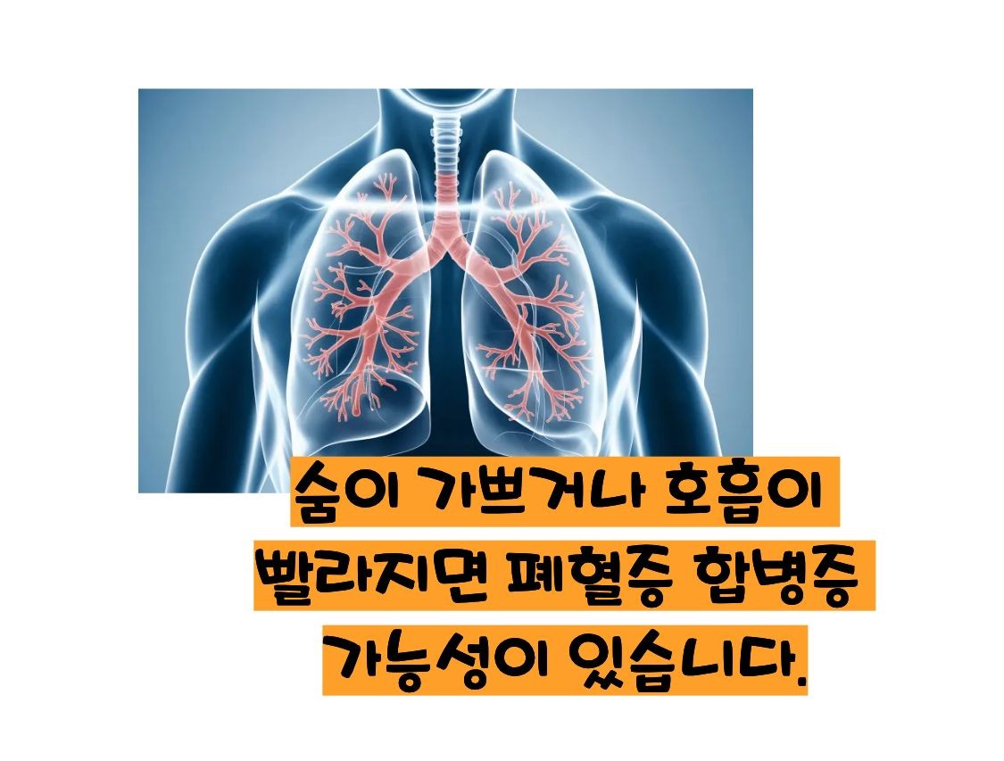 패혈증 이란?