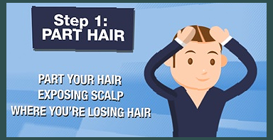 커클랜드 미녹시딜 직구