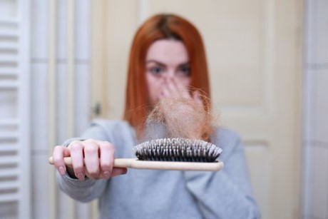 원형탈모 클록스액