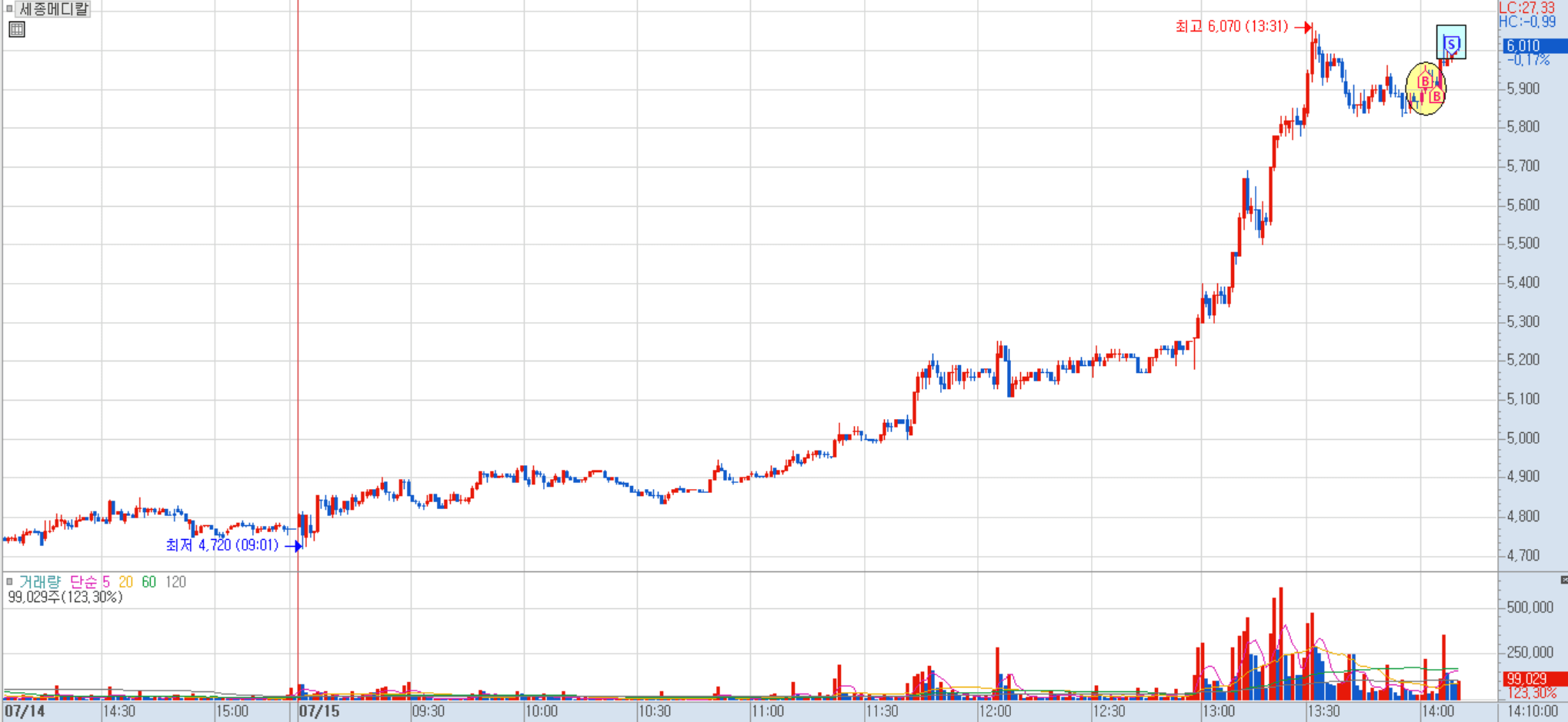 세종메디칼 분봉 차트 1)