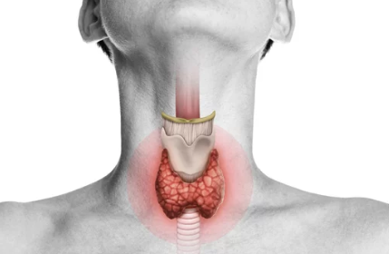갑상선기능저하증/출처:어도비스톡