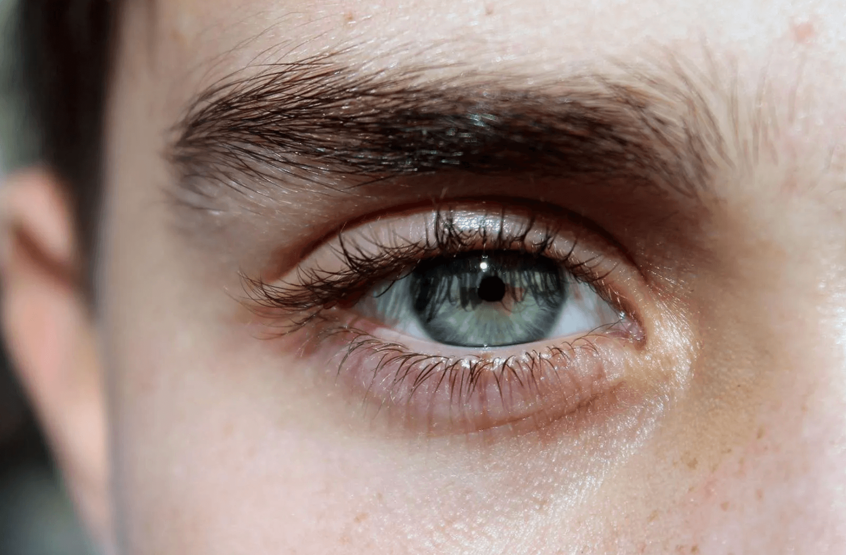 남자 눈매교정 비용