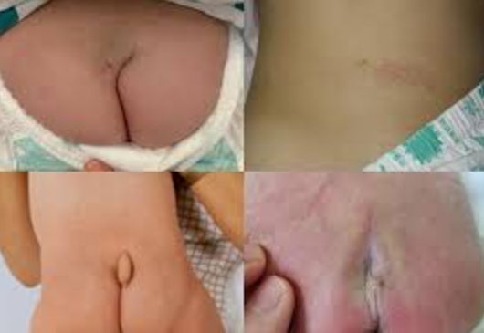 검사 및 치료 비용과 건강보험 적용