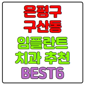 은평구 구산동 임플란트 치과 가격 비용 싼 곳,저렴한 곳,잘하는 곳,유명한 곳 BEST6 추천