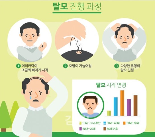 탈모 진행 과정/ 출처 - 네이버블로그[시흥 두피/탈모관리센터]