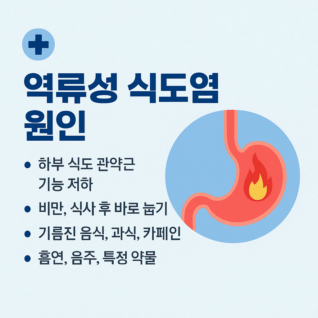 역류성식도염