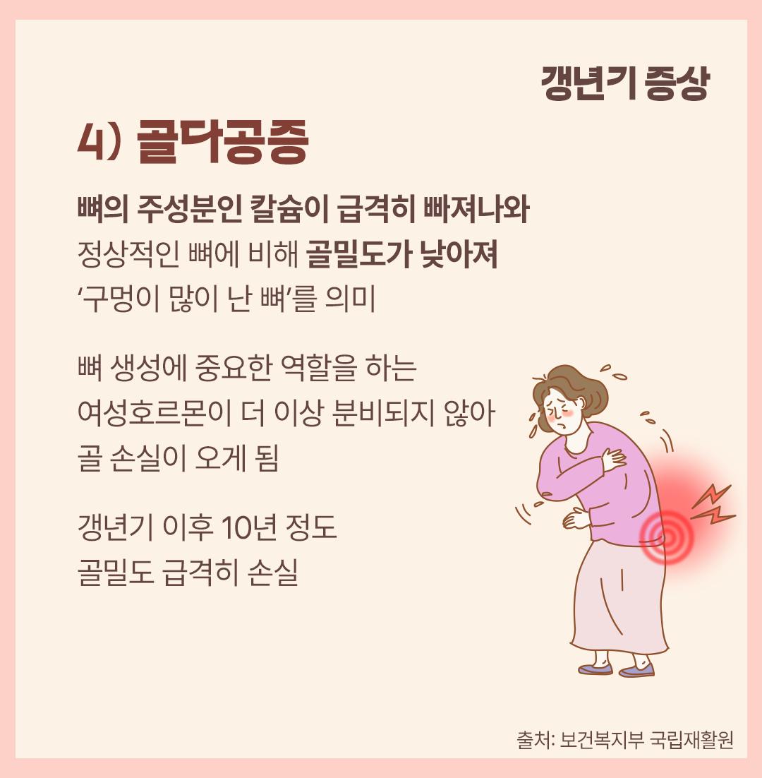 #갱년기 증상 골다공증