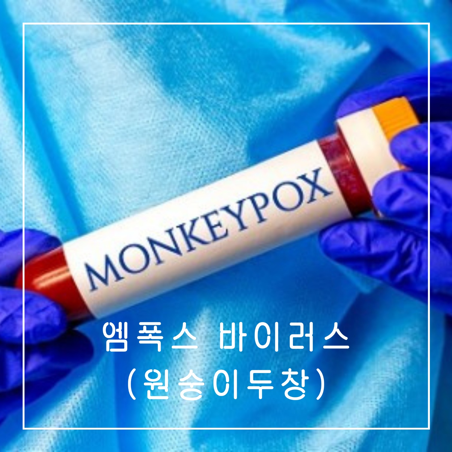 엠폭스-바이러스