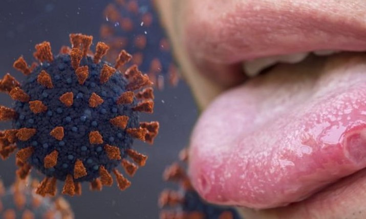 혓바늘 치료제 약 추천