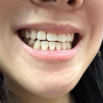 주기적인 치아 검진