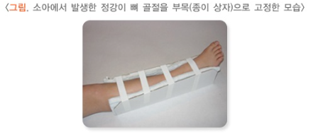 골절 치료