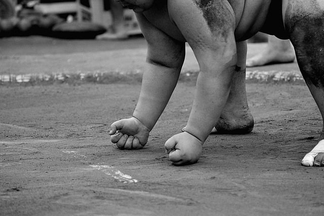 비만 수술의 종류와 주의점 알아보기