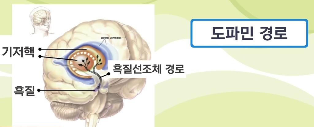 파킨슨과 알츠하이머