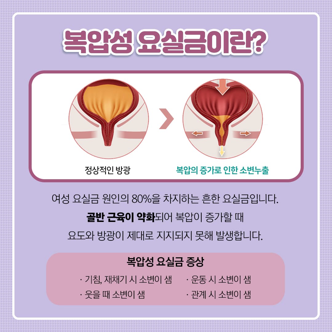 복압성 요실금이란?