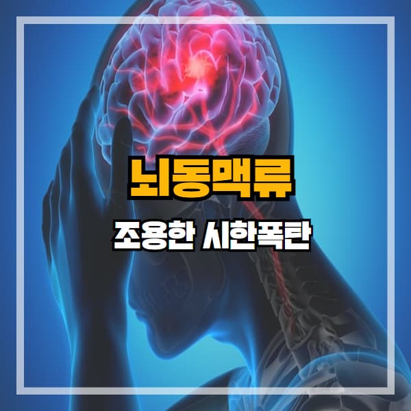 뇌동맥류, 터지기 전까지는 아무 증상도 없습니다.