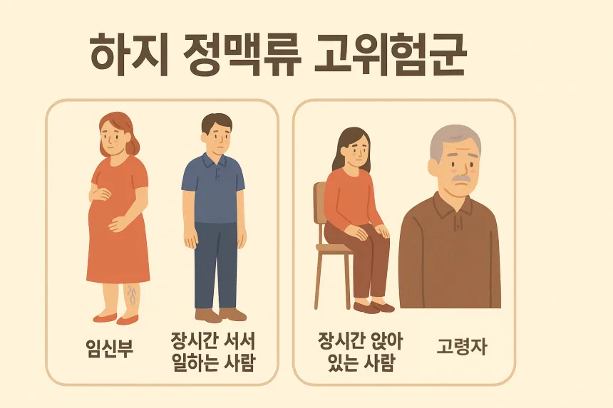 하지 정맥류 증상