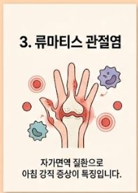 류마티스 관절염 초기증상