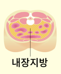 내장지방 빼는법