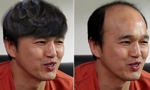 모발샴푸