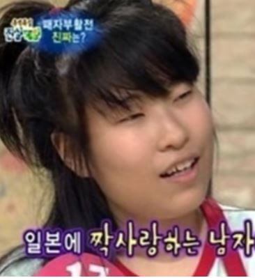 이세영 성형